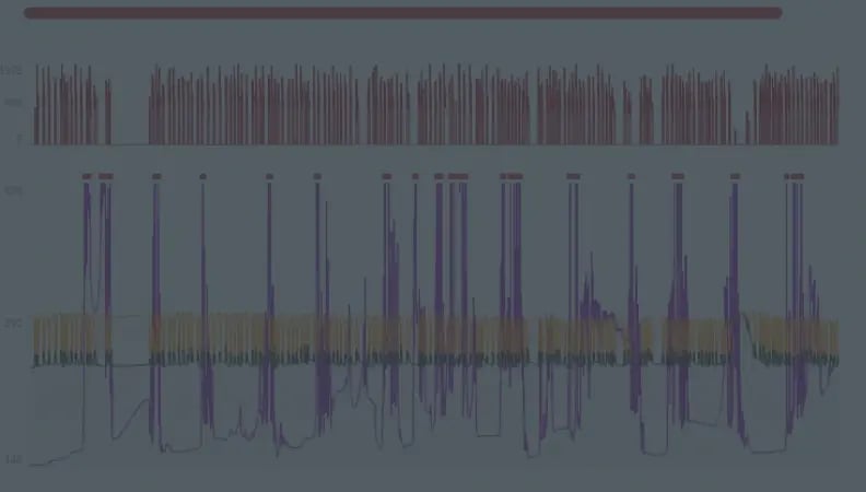 Plunger Lift Anomaly: Miscalibrated Sensor