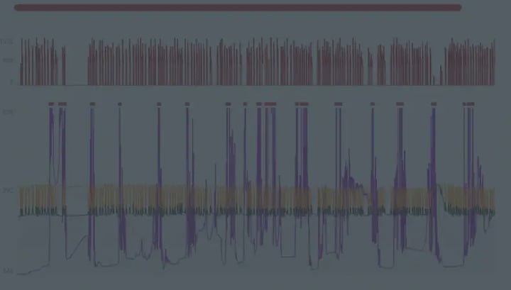 Plunger Lift Anomaly: Miscalibrated Sensor